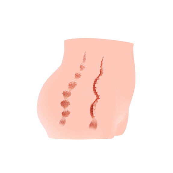 Kokos Cherry Masturbator